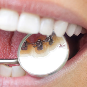 leczenie ortodontyczne opole