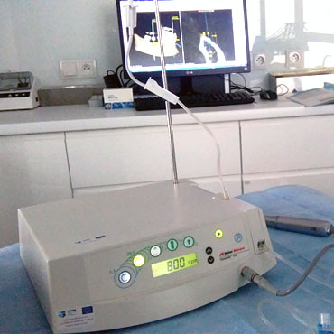 unity implantologiczne