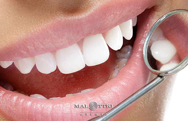 implanty zębów opole