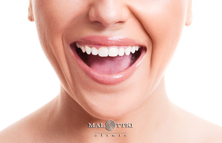 implanty dentystyczne malottki opole