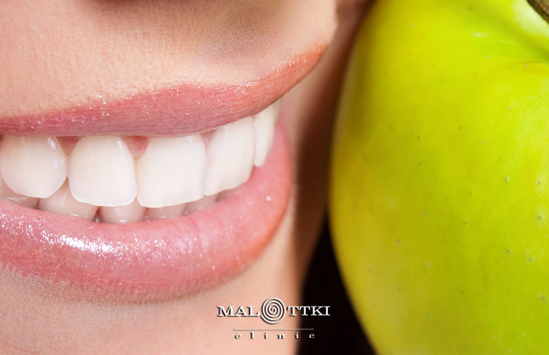 rekonstrukcja zęba opole