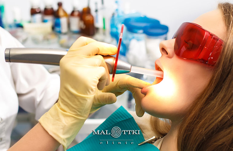 wypełnienia zębów opole