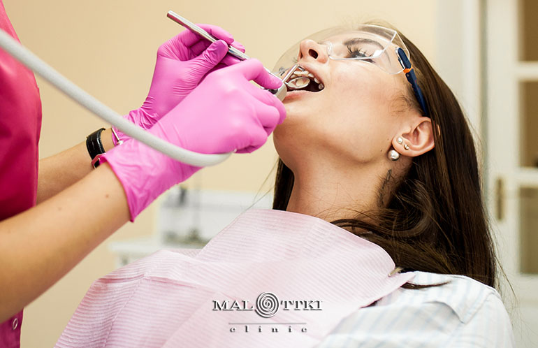 leczenie próchnicy opole