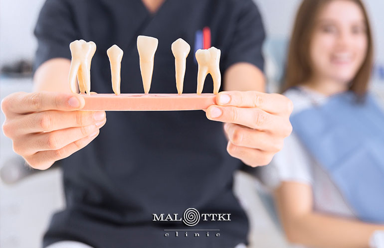 usuwanie zębów opole