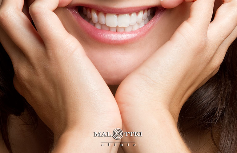 fluoryzacja zębów opole