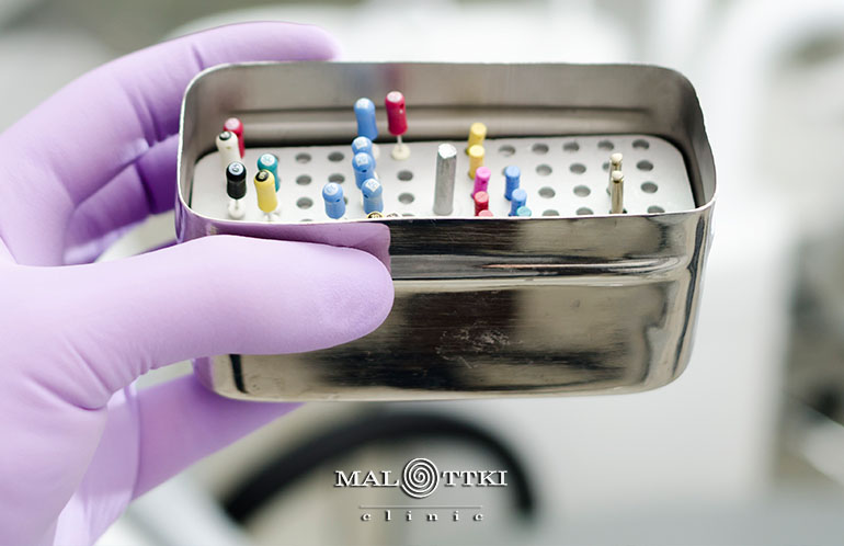 powtórne leczenie kanałowe opole malottki