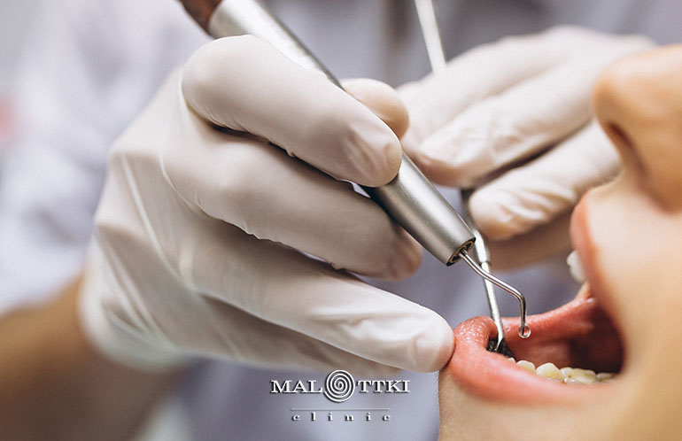 bezbolesne leczenie zębów opole