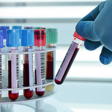 fibryna bogatopłytkowa