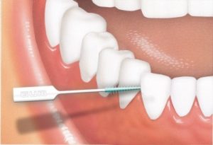 czyściki międzyzębowe