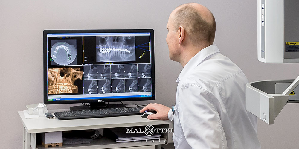 diagnostyka stomatologiczna opole
