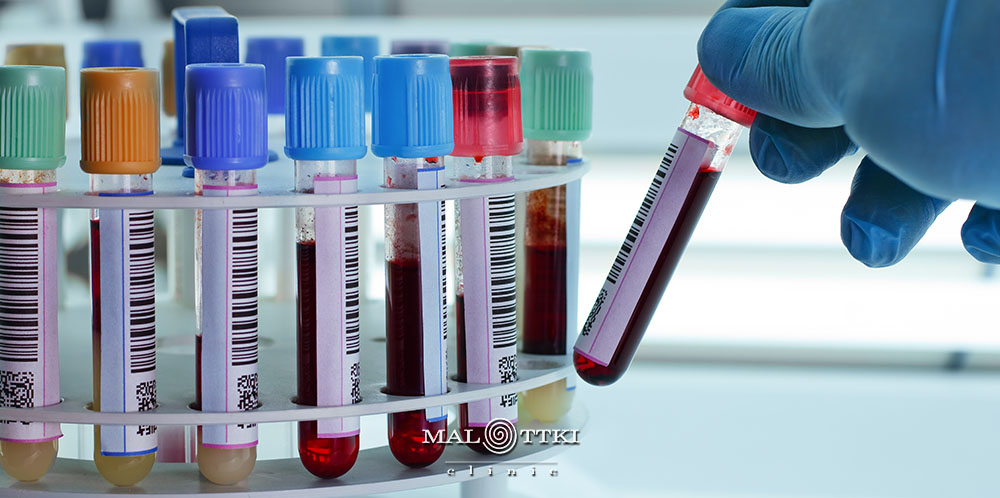 fibryna bogatopłytkowa