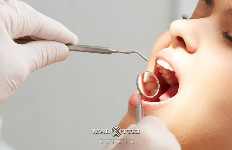 higienizacja stomatologiczna opole