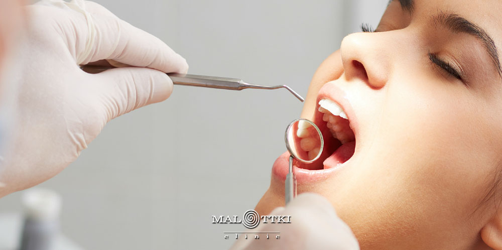 higienizacja zębów