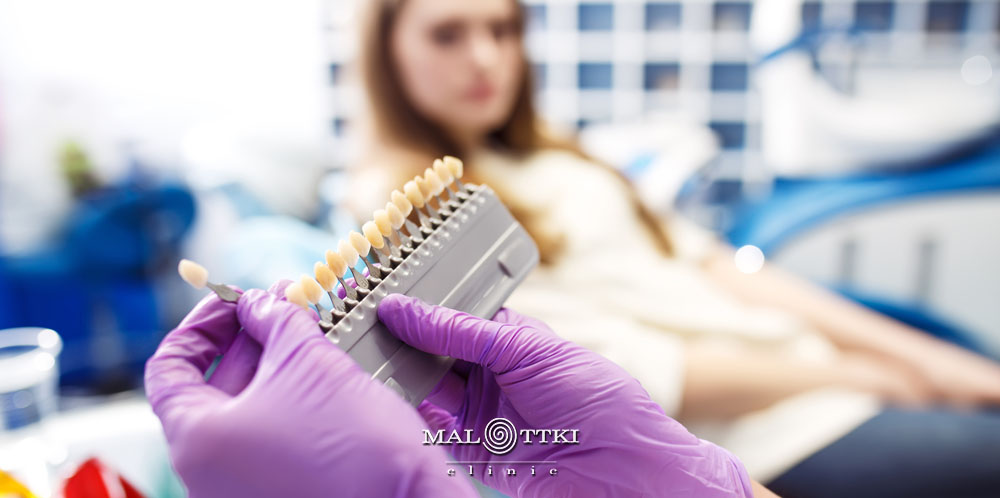 licówki porcelanowe opole