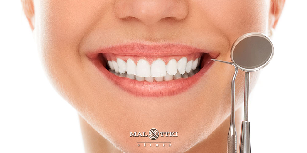 profilaktyka stomatologiczna