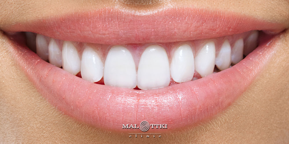 stomatologia estetyczna opole