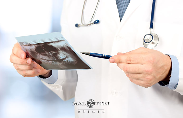 rtg zębów malottki opole