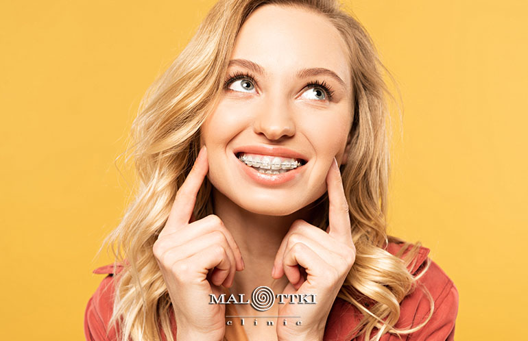 przebieg leczenia ortodontycznego malottki