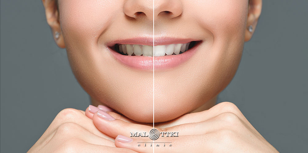 metamorfozy stomatologiczne