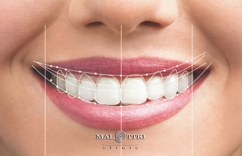 digital smile design