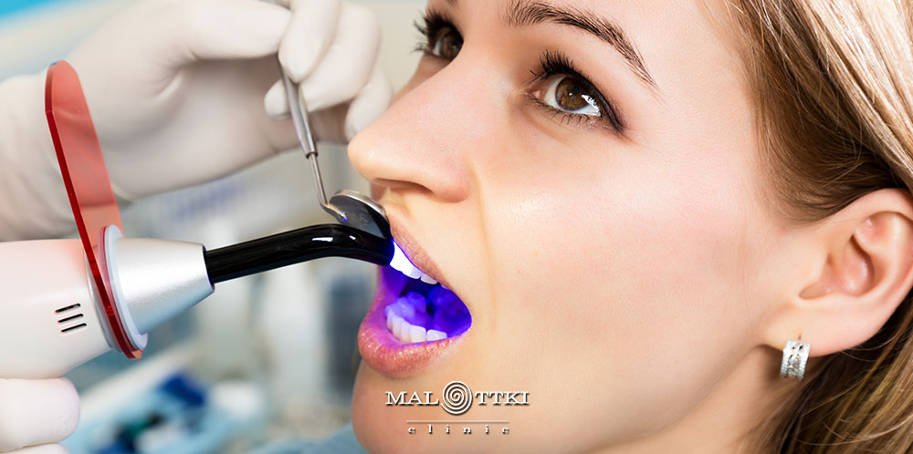 icon-usuwanie-przebarwien-na-zebach