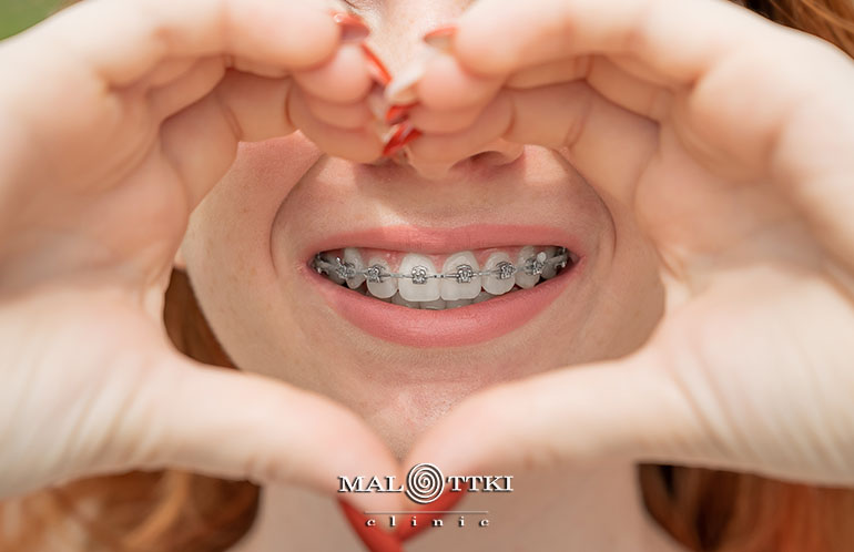 aparat stały metalowy opole