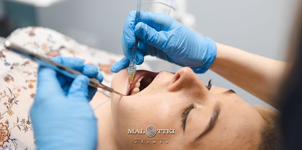 bezbolesne znieczulenie zębów