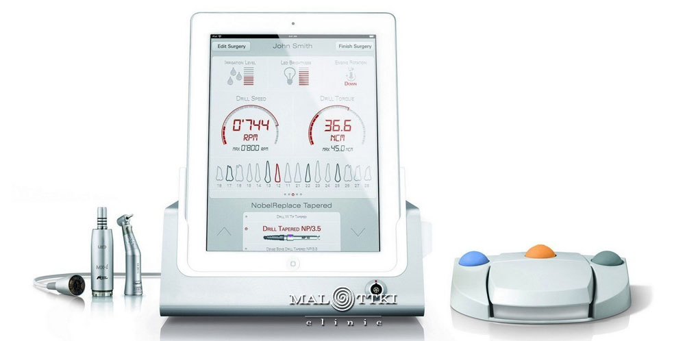 unity implantologiczne