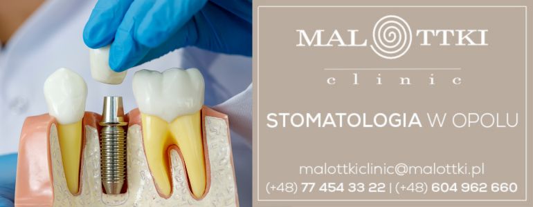 Implant na całe życie