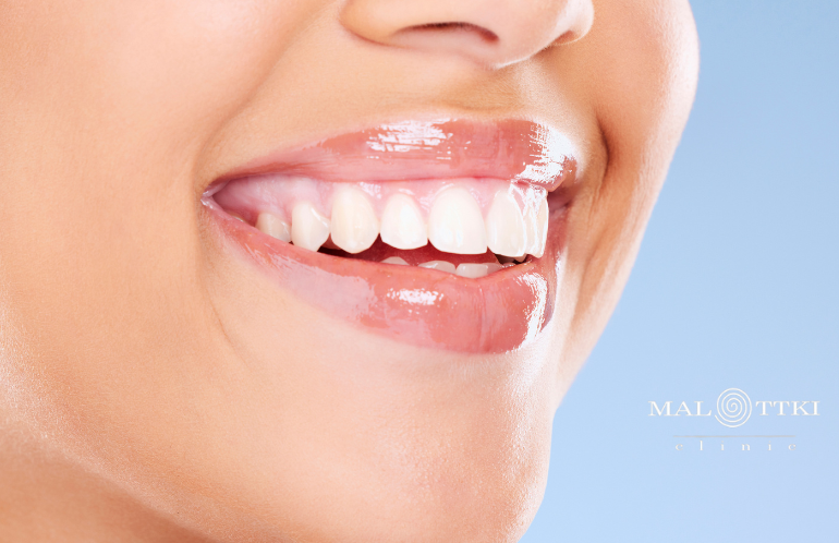 stomatologia estetyczna opole